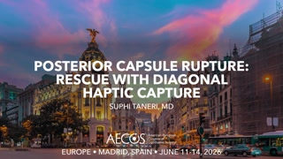 Posterior Capsule Rupture- Rescue with Diagonal Haptic Capture